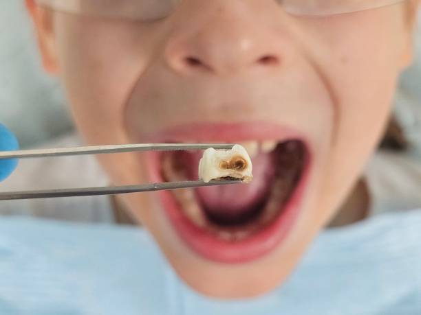 Best Pediatric Emergency Dentist in Bradford, TN