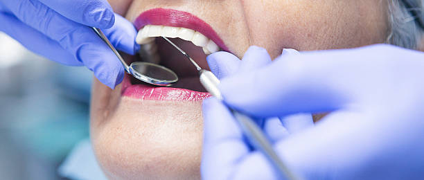 Best Emergency Dentist for Knocked-Out Tooth in Bradford, TN